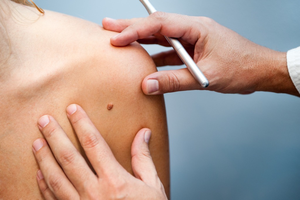 How-to-reduce-your-risk-of-developing-skin-cancer