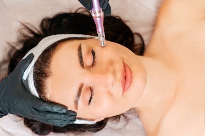 8-benefits-of-radiofrequency-microneedling-for-skincare